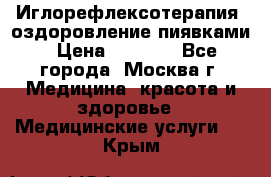 Иглорефлексотерапия, оздоровление пиявками › Цена ­ 3 000 - Все города, Москва г. Медицина, красота и здоровье » Медицинские услуги   . Крым